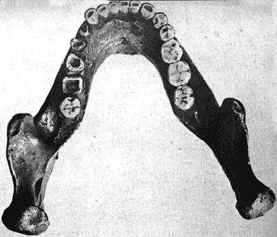 Homo heidelbergensis jaw