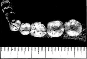 La Quina 9 dentition