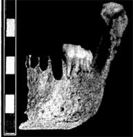 La Quina 9 mandible