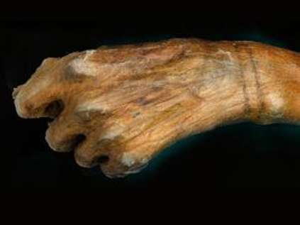 Otzi