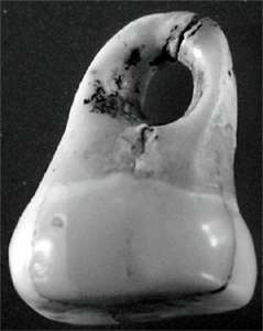 human molar