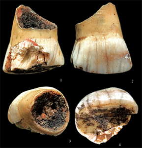 zarysk milk tooth