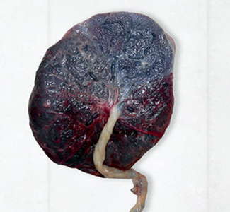 placenta