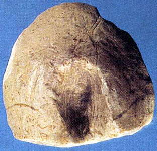 Vulva