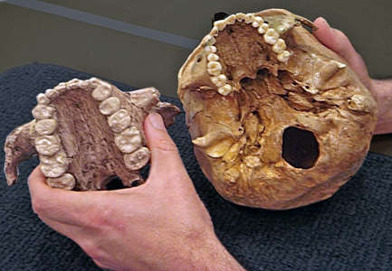 Australopithecus boisei