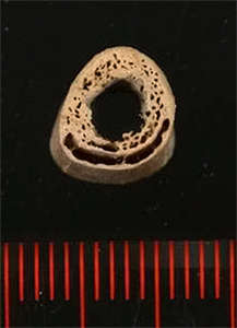 bone crosssection 