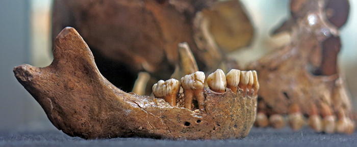 mandible 