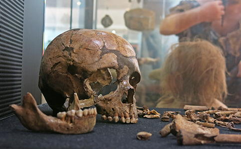 skull and mandible 