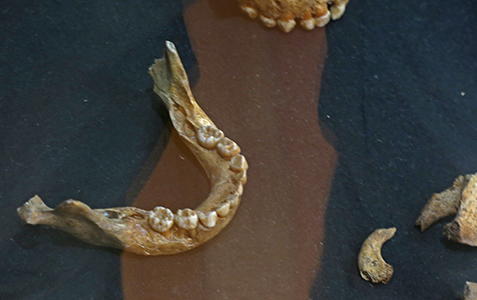 mandible 