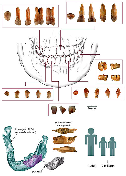 teeth diagram