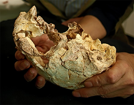 skull being restored