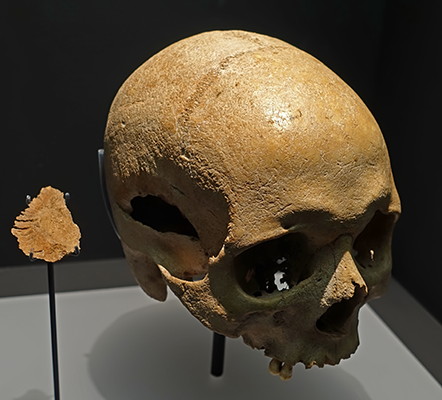 skull