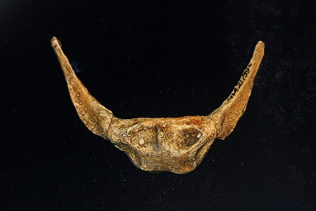 hyoid bone