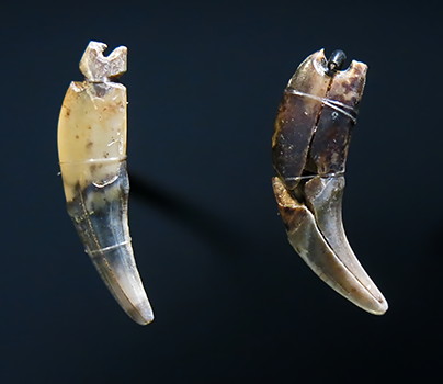 Teeth and rings