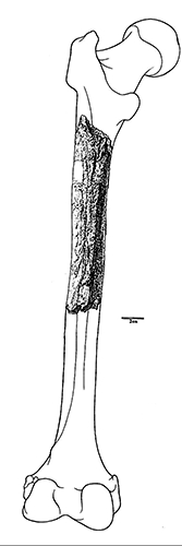 ulna