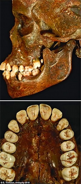 Sungir burial skull