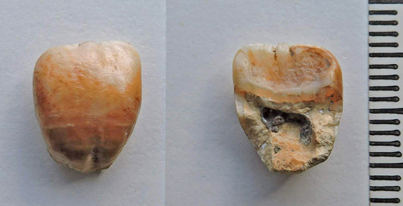 neanderthaltoothsm