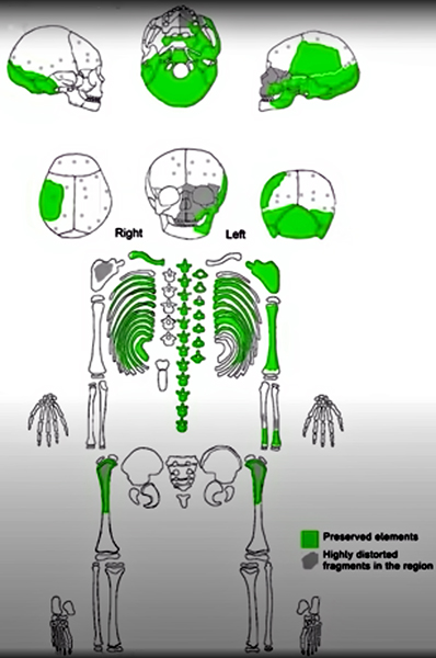 preservedpartsofskeletonsm