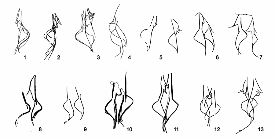Lalinde Figures