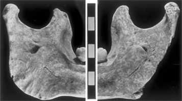 oase skull