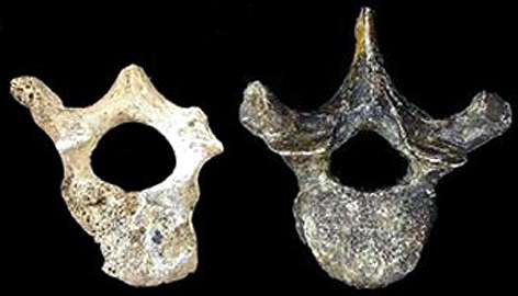 dmanisi vertebra