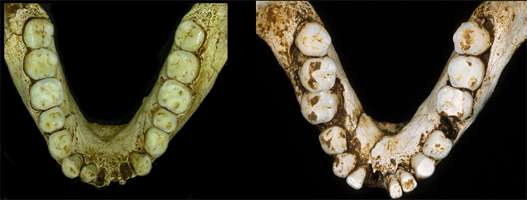 hobbit jaw